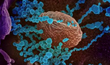 COVID-19: El laboratorio de la UBA procesará muestras para el Municipio de Cañuelas